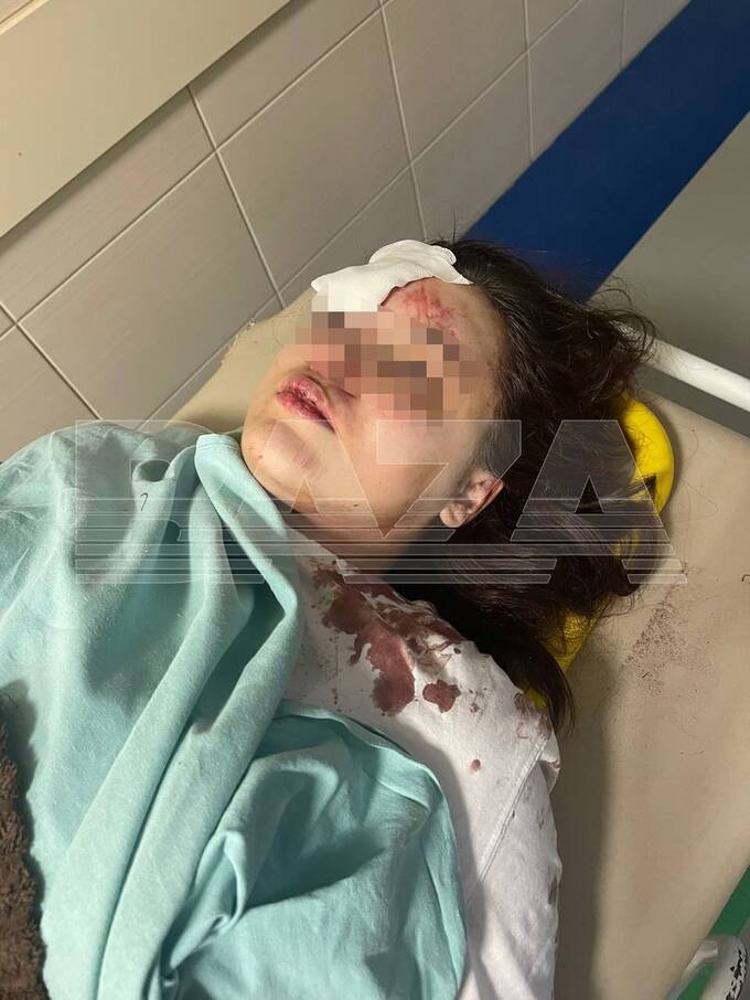 В Подмосковье дрифтер, ехавший по встречке, сбил девушку на самокате