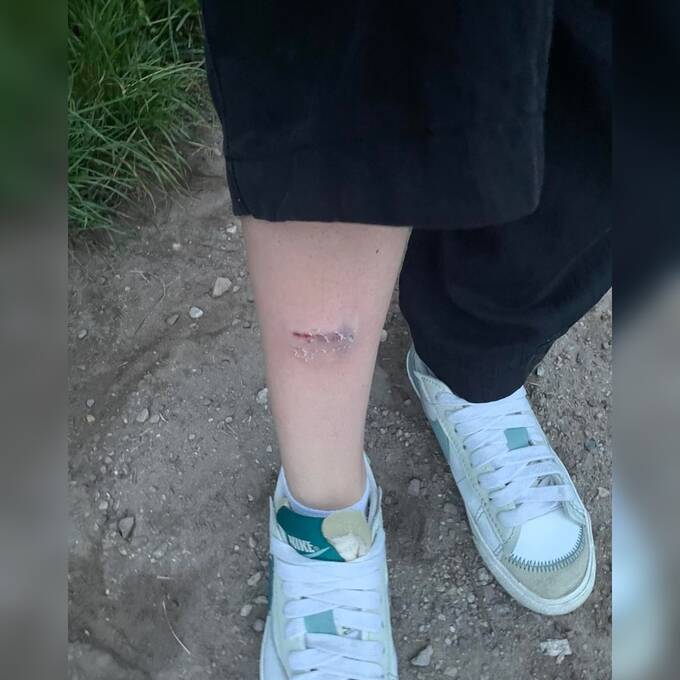 В Варшаве хаски напали на болонку в парке