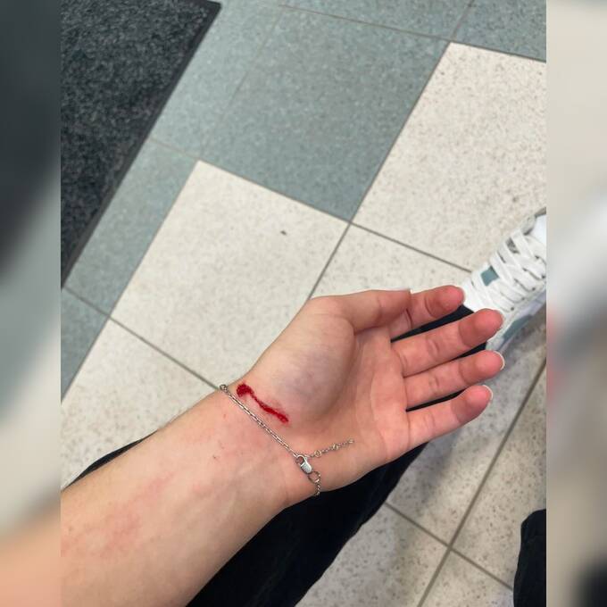 В Варшаве хаски напали на болонку в парке