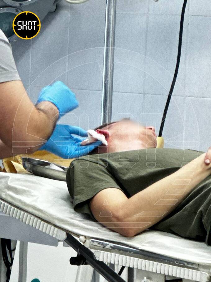 Барбер в Тюмени случайно отрезал клиенту кусок уха