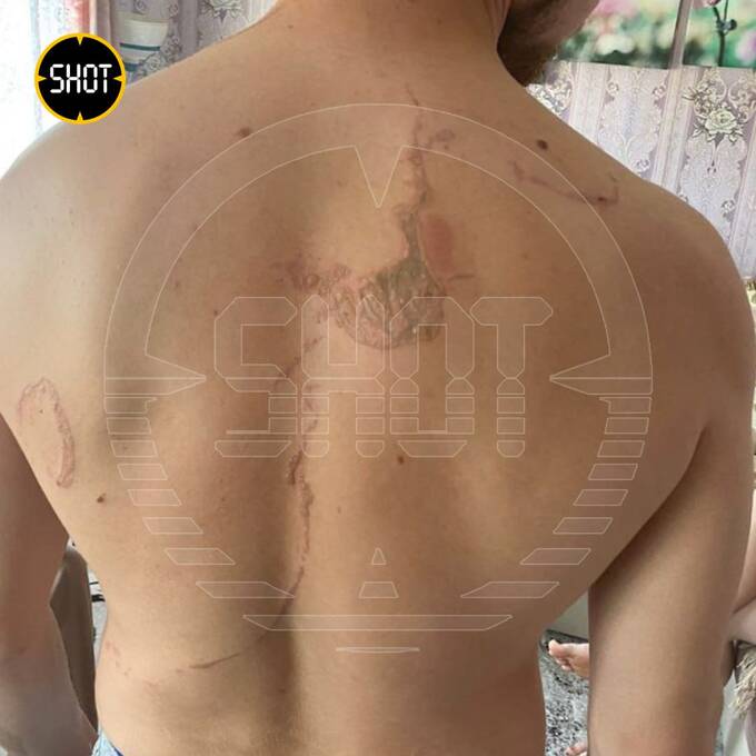 В Удмуртии в сауне во время вечеринки загорелась печка: есть пострадавшие dddidtdiduihqkmp