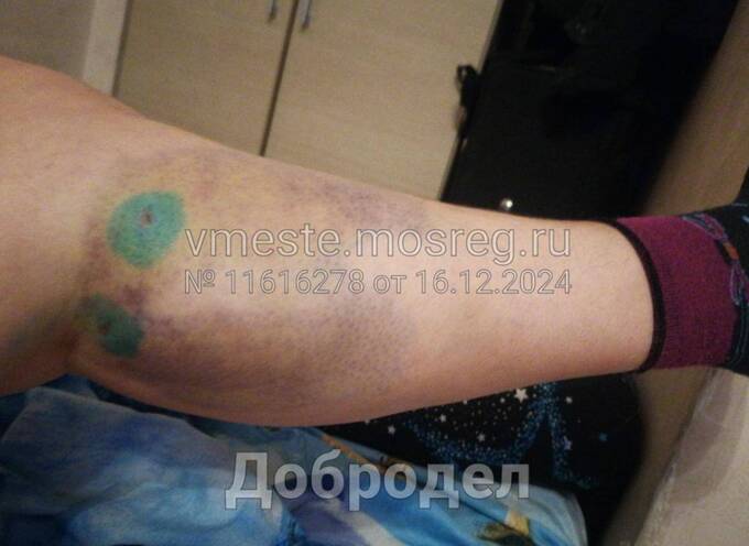Бродячие собаки продолжают атаковать жителей Подмосковья