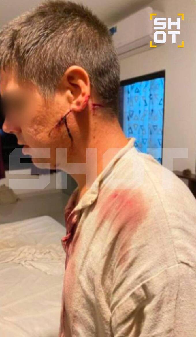 В Индии на российских туристов напали двое неизвестные с мачете