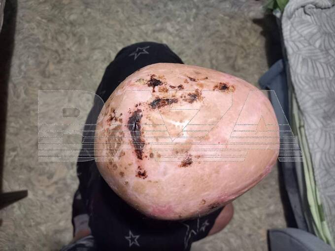В Самаре девушка потеряла скальп на производстве