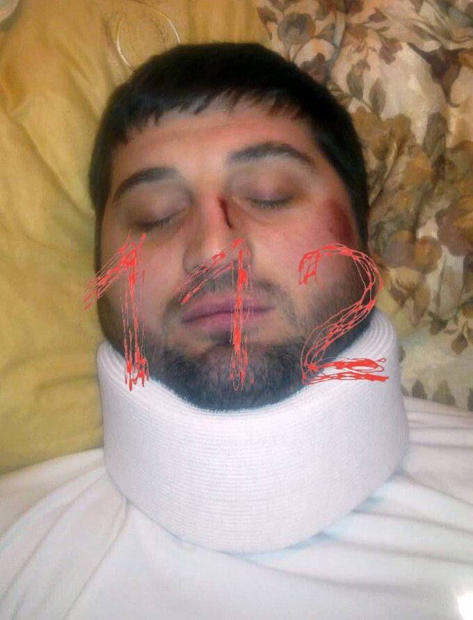 В Ингушетии совершено покушение на экс-начальника полиции Карабулака Илеза Нальгиева qkzihziekiqrdkmp