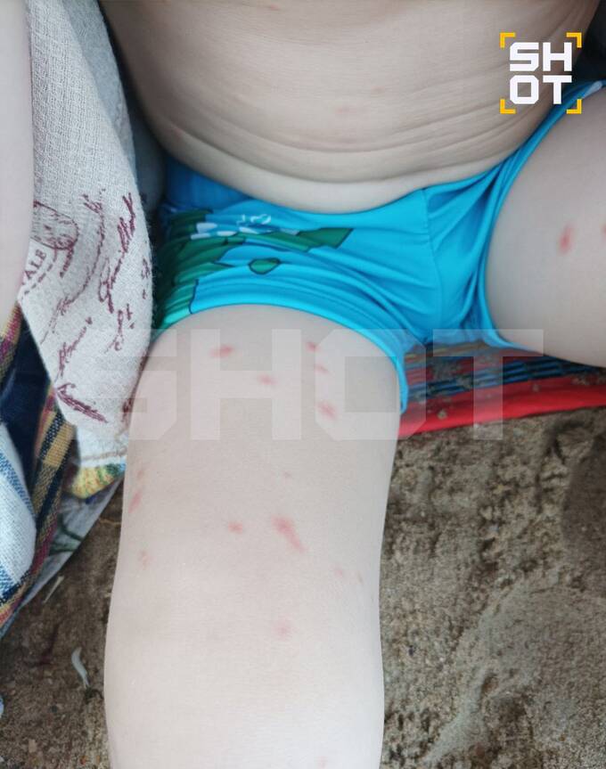Вспышка денге в Таиланде: новое заболевание распространяется среди туристов