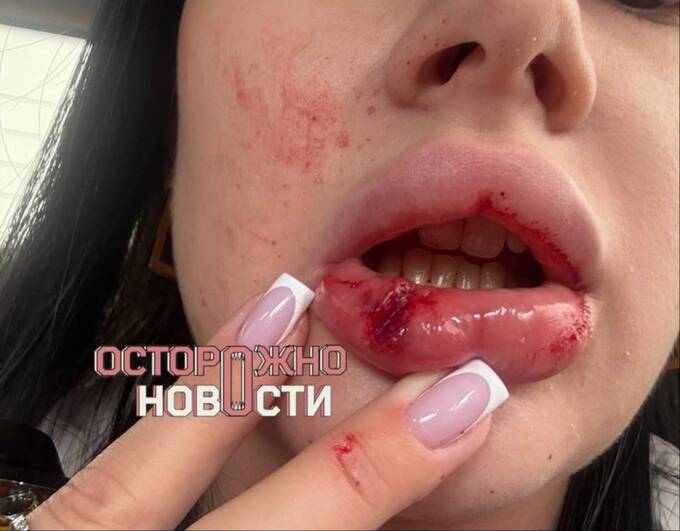 Участник «СВО» в Нижневартовске месяцами преследует бывшую жену qhtiqzkidhiqqtkmp
